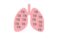 Human lungs with TB disease