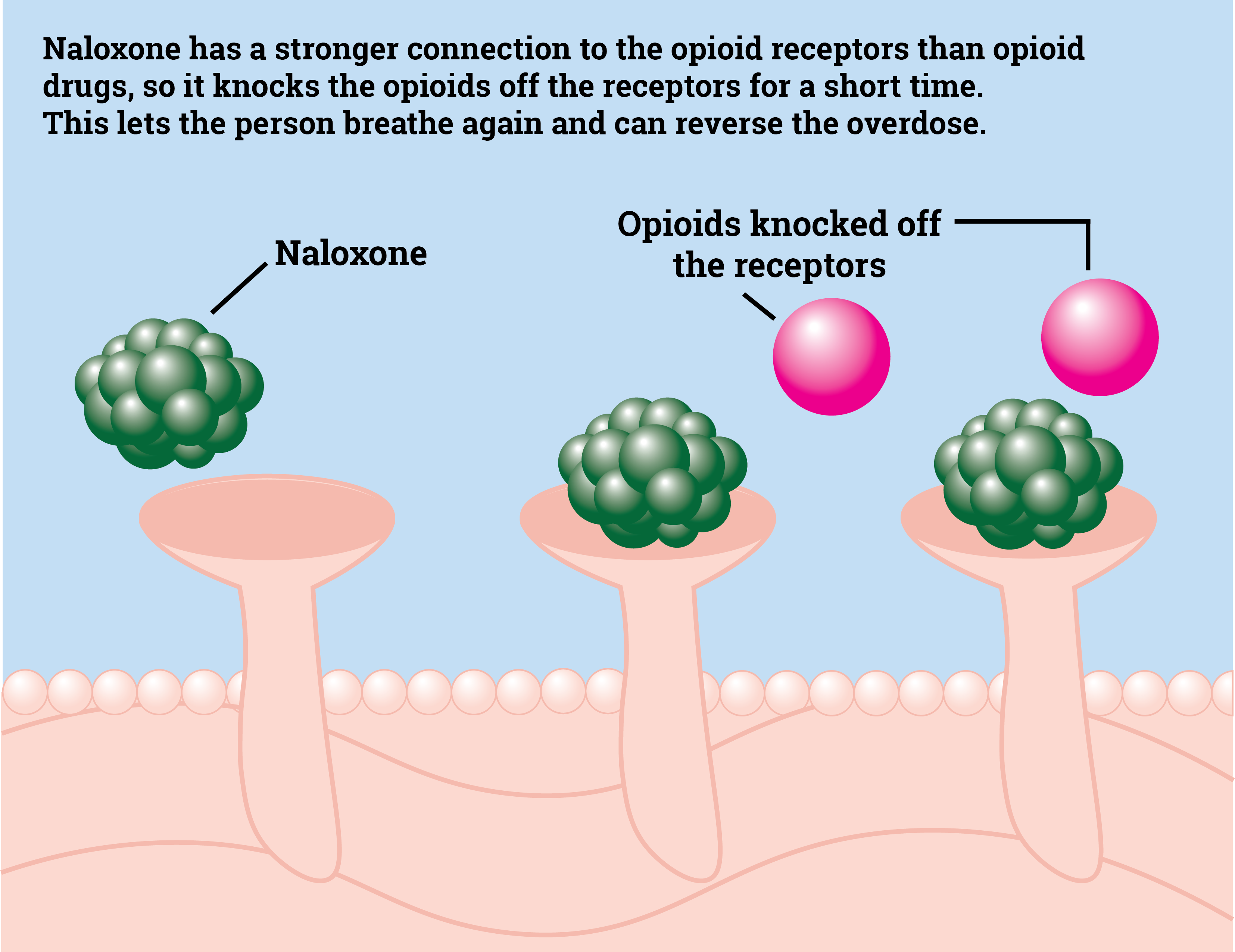 Depiction of naloxone knocking off opioids from brain receptors